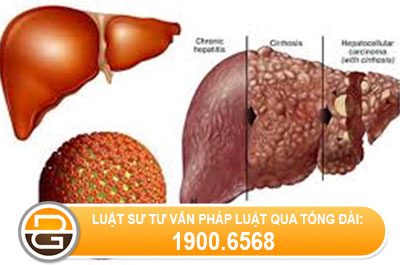 viem-gan-b-co-duoc-di-nghia-vu-cong-an-khong
